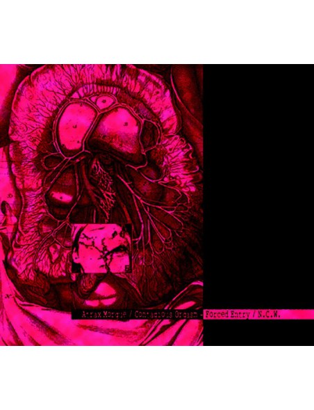 Atrax Morgue / Contagious Orgasm - Forced Entry / N.C.W. [CD]